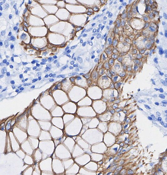 EHD1 Antibody