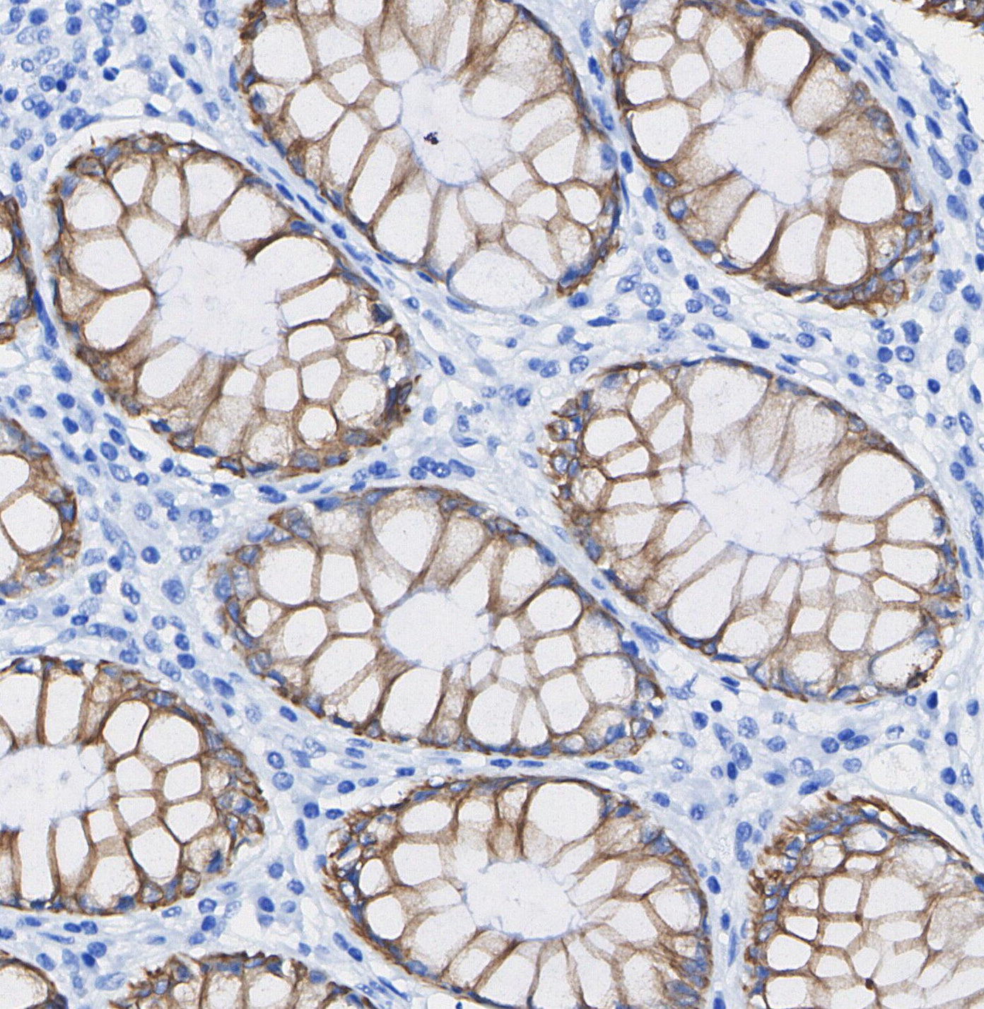 Cyclin B2/CCNB2 Antibody