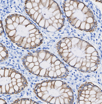Cyclin B2/CCNB2 Antibody