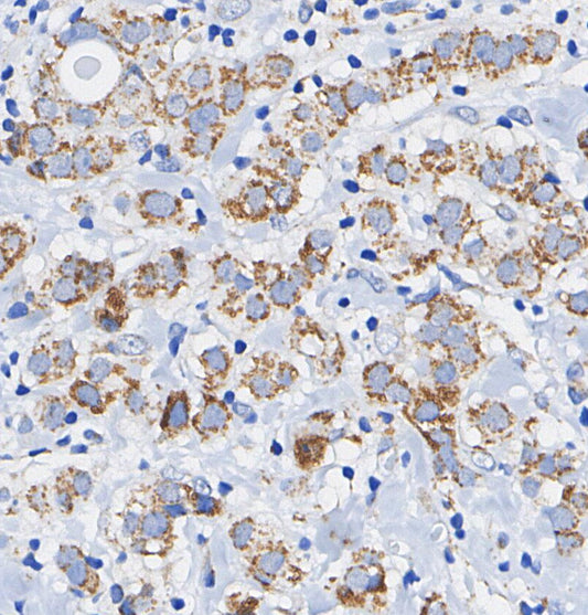 CLPP Antibody
