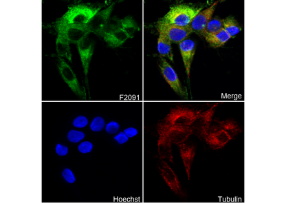 Fascin Antibody