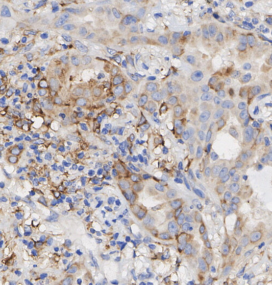 Fascin Antibody