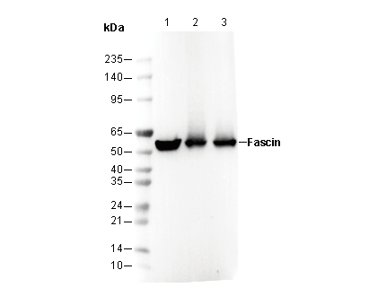 Fascin Antibody
