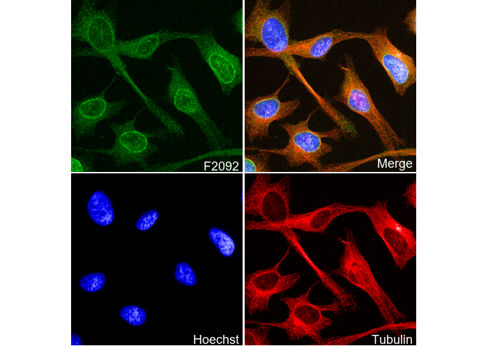 Lamin B Receptor/LBR Antibody