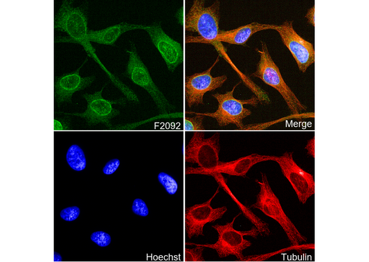Lamin B Receptor/LBR Antibody