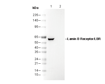 Lamin B Receptor/LBR Antibody
