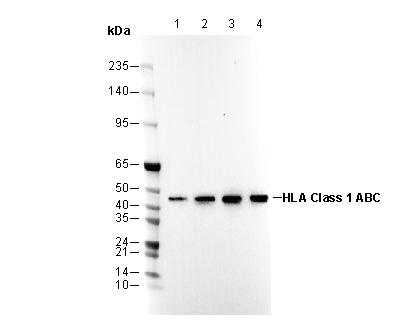 HLA Class 1 ABC Antibody