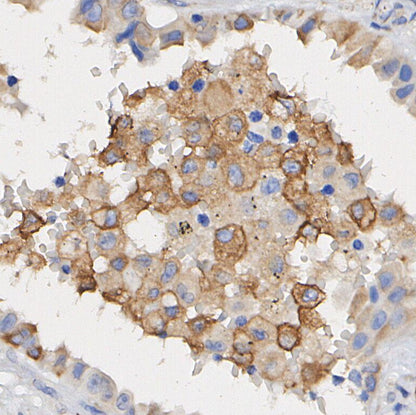FAAH1 Antibody