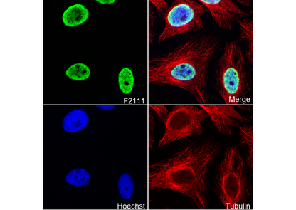 Acetyl-Histone H3 (Lys14) Antibody