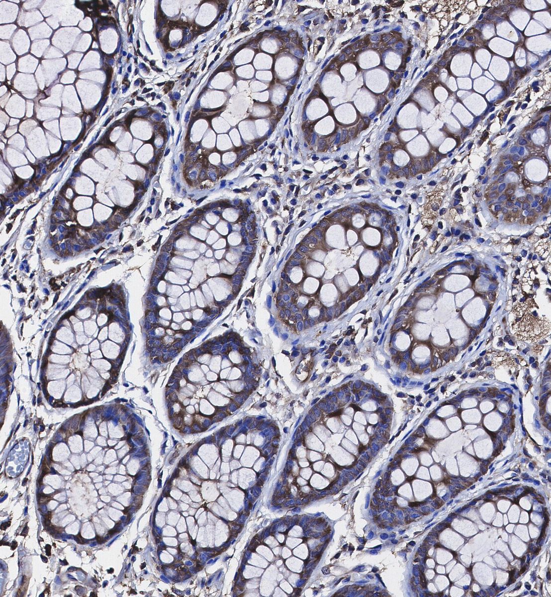 STK3/MST-2 Antibody
