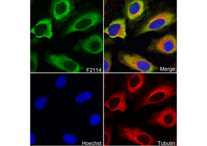 Stathmin 1 Antibody