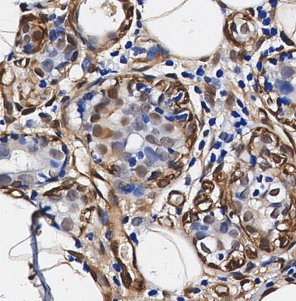 DYNLL1/PIN Antibody