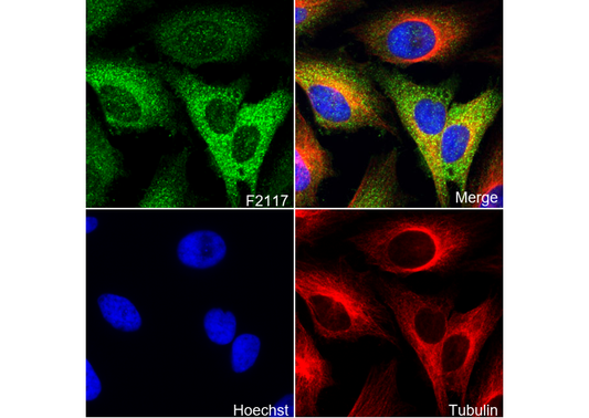 Phospho-PAK1/2/3 (Ser144/141/154) Antibody