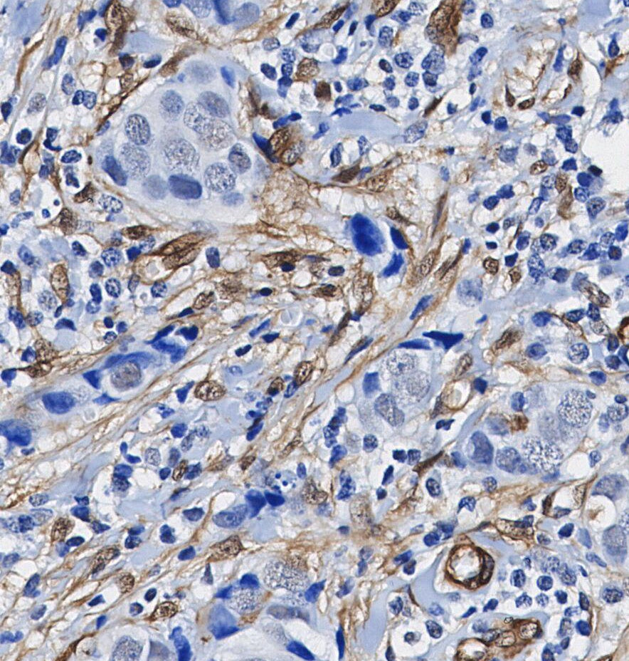 Plectin Antibody