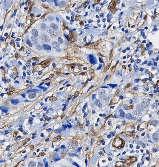 Plectin Antibody