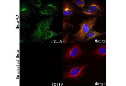 Phospho-PKAR2/PKR2 (Ser99) Antibody
