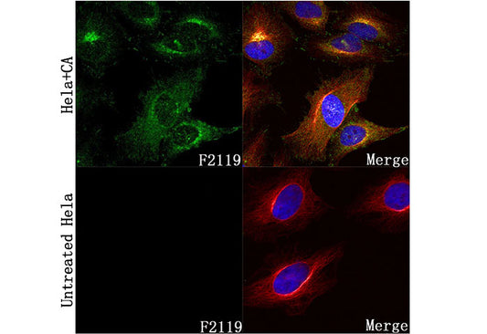 Phospho-PKAR2/PKR2 (Ser99) Antibody