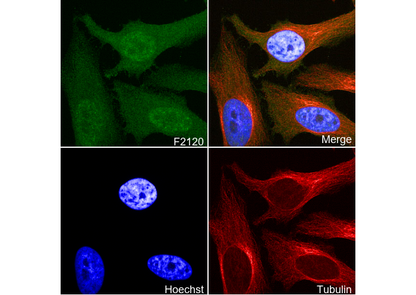 Phospho-CDK1/2/3 (Thr14) Antibody