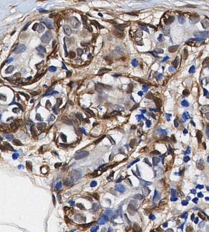 Phospho-CDK1/2/3 (Thr14) Antibody