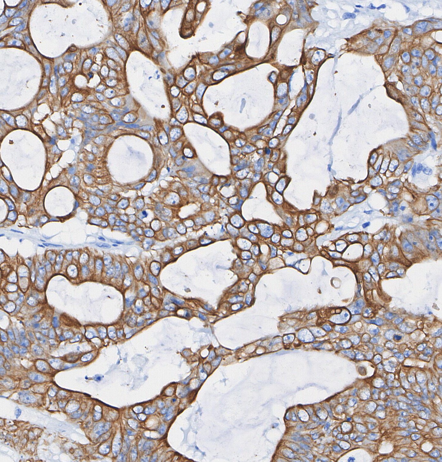 TIM 3 Antibody