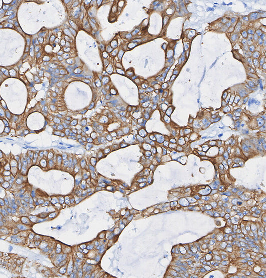 TIM 3 Antibody