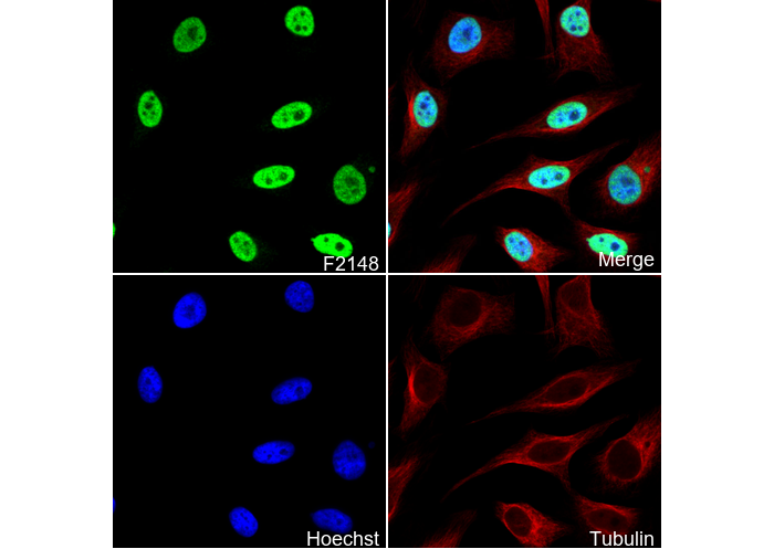 SMARCA2 / BRM Antibody