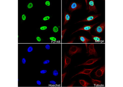 SMARCA2 / BRM Antibody