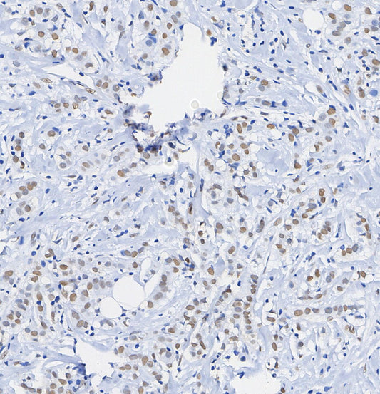 SMARCA2 / BRM Antibody