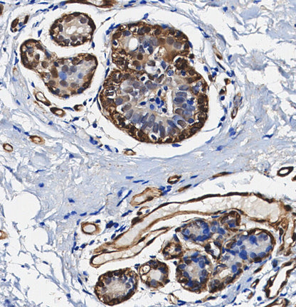 Choline Acetyltransferase Antibody