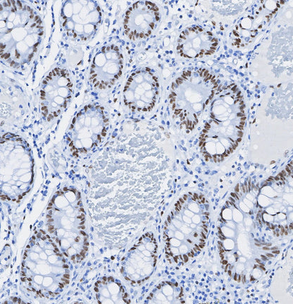 FOXA1 Antibody