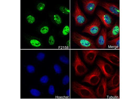 53BP1 Antibody