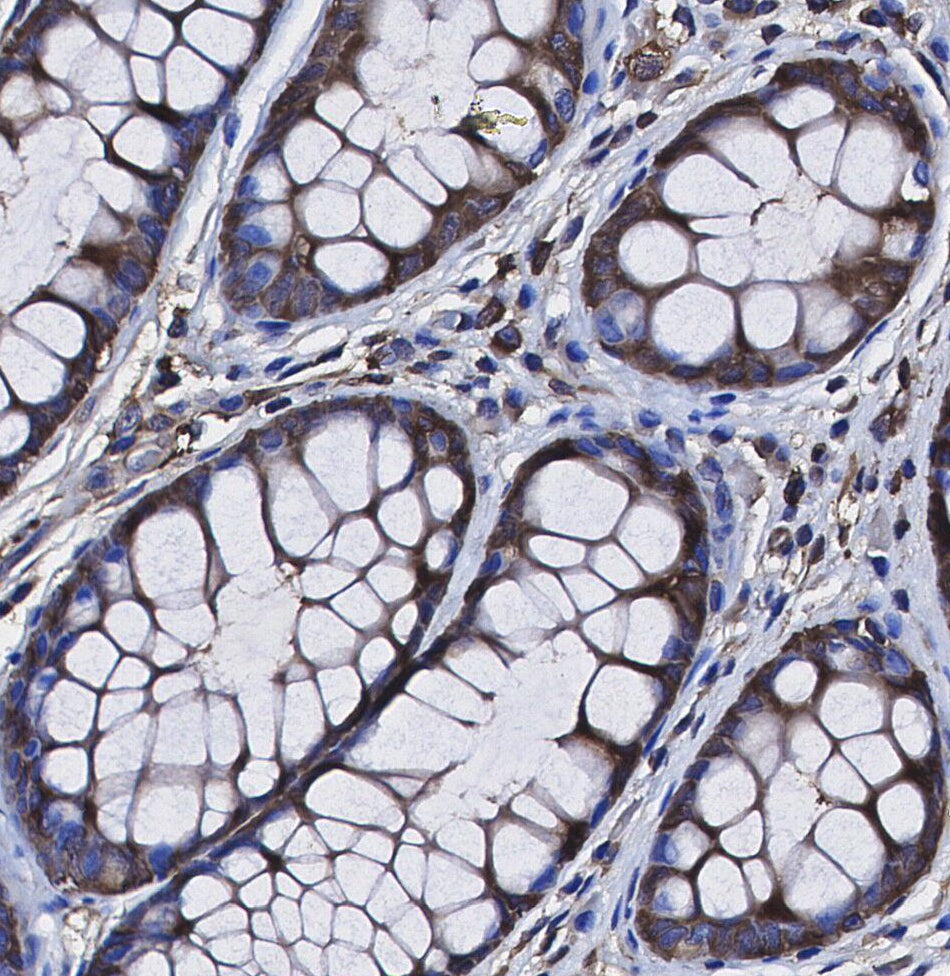 Lumican Antibody
