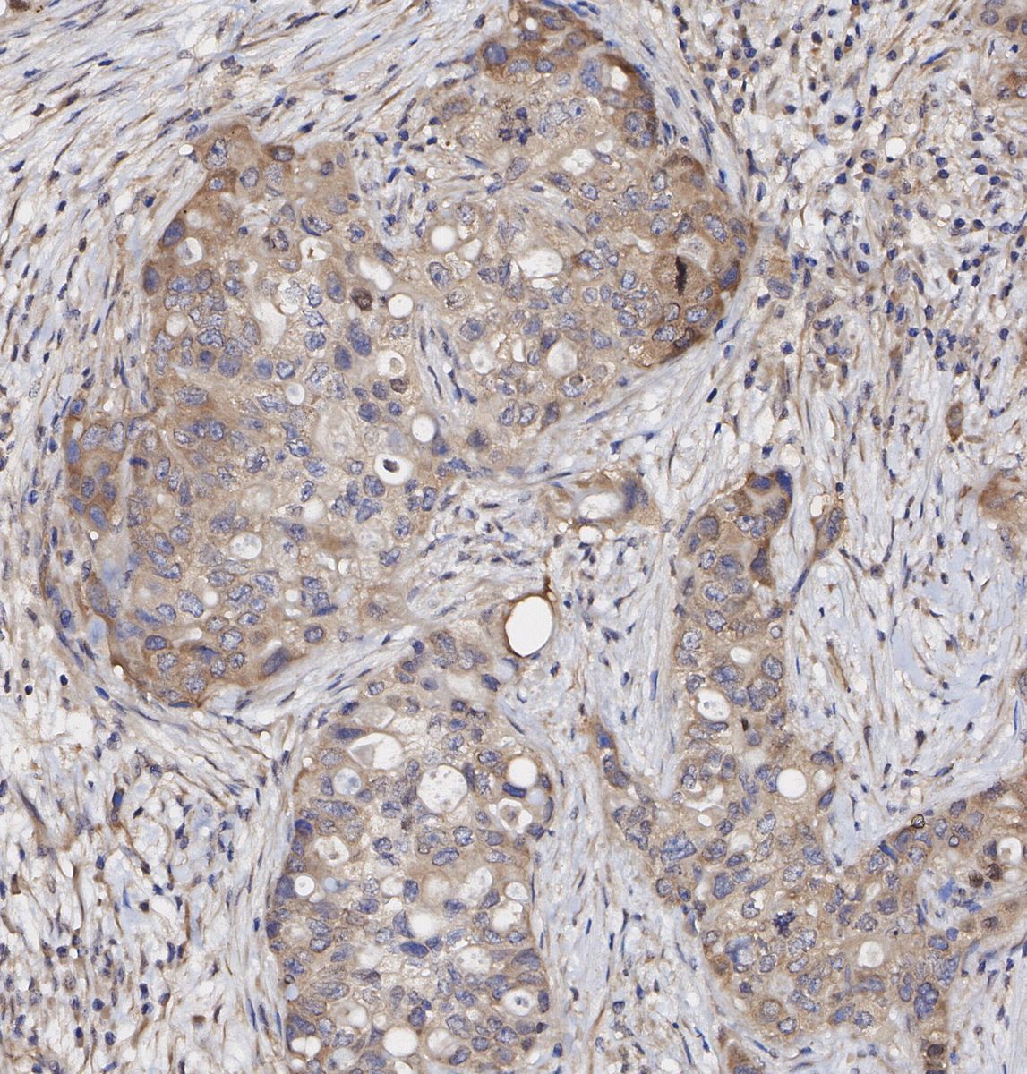 KIF5B + KIF5C Antibody