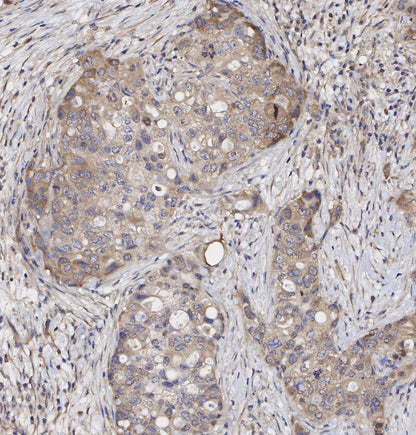 KIF5B + KIF5C Antibody