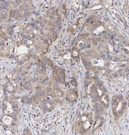 TRIM25/EFP Antibody