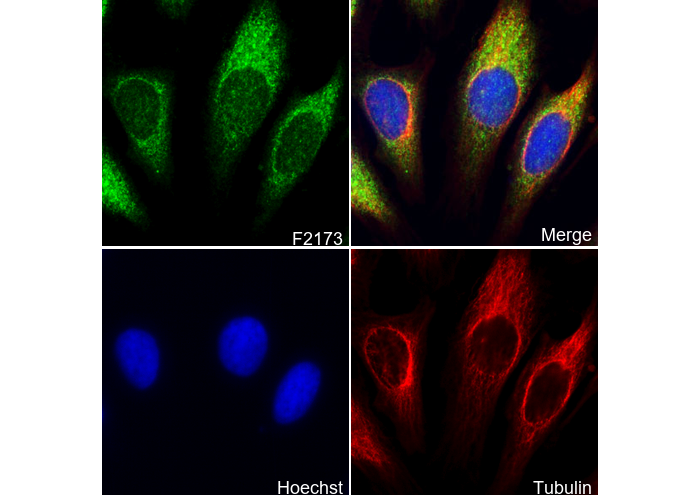 Cytochrome P450 17A1/CYP17A1 Antibody