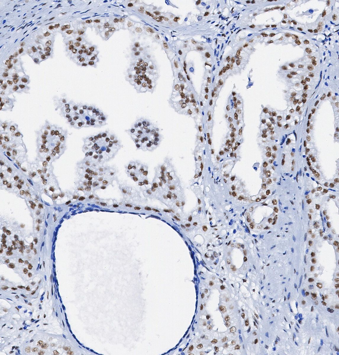 SUN2 Antibody