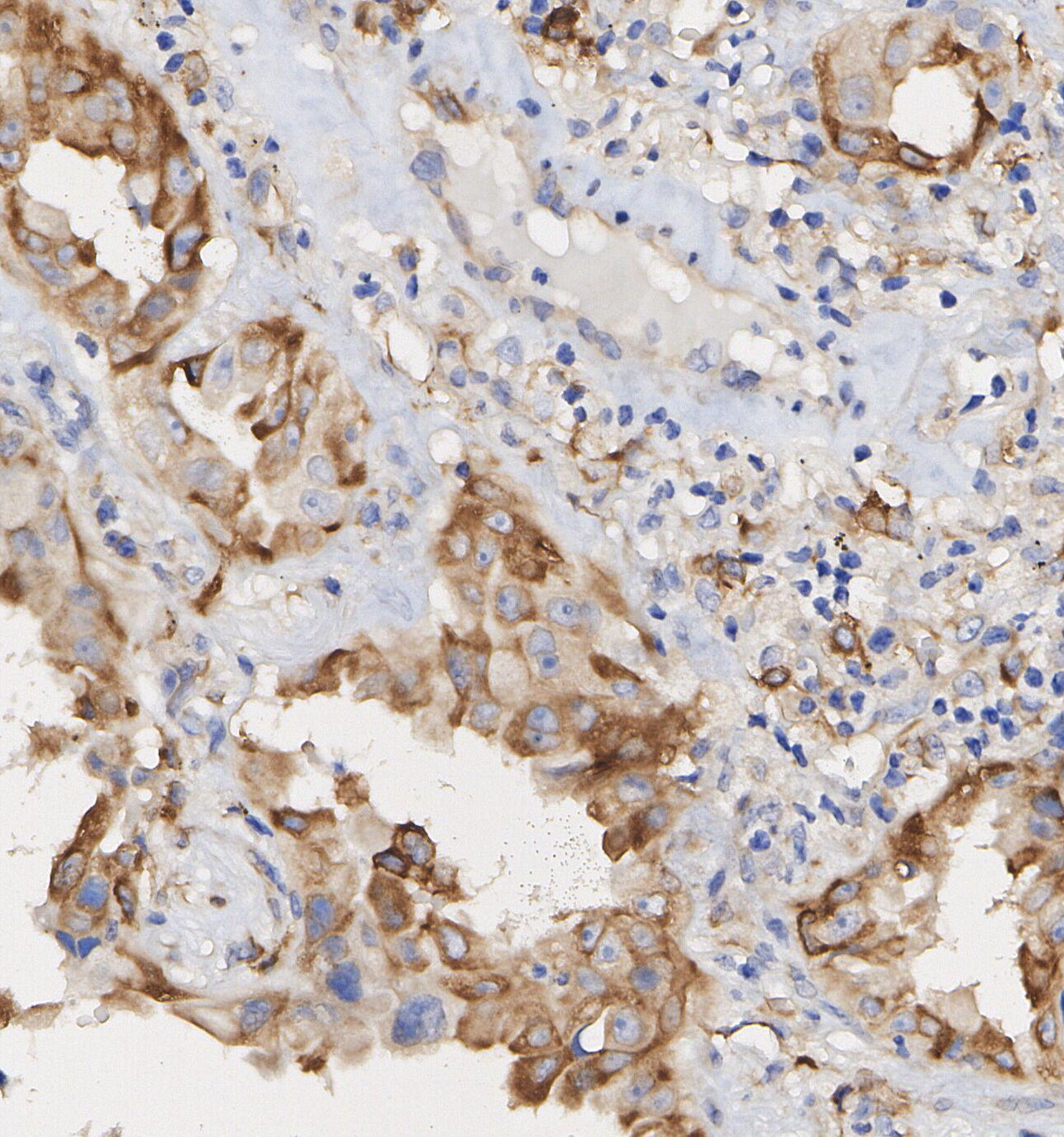 Hsp47 Antibody