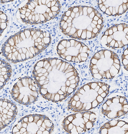 Cytokeratin 13 Antibody