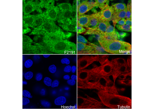 VAMP8/EDB Antibody