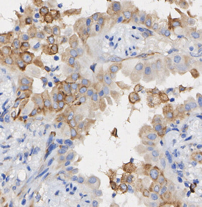 VAMP8/EDB Antibody