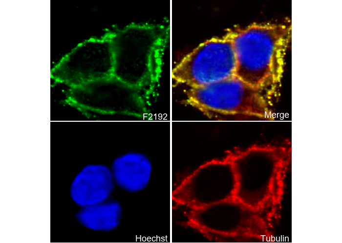 Sodium Potassium ATPase Antibody