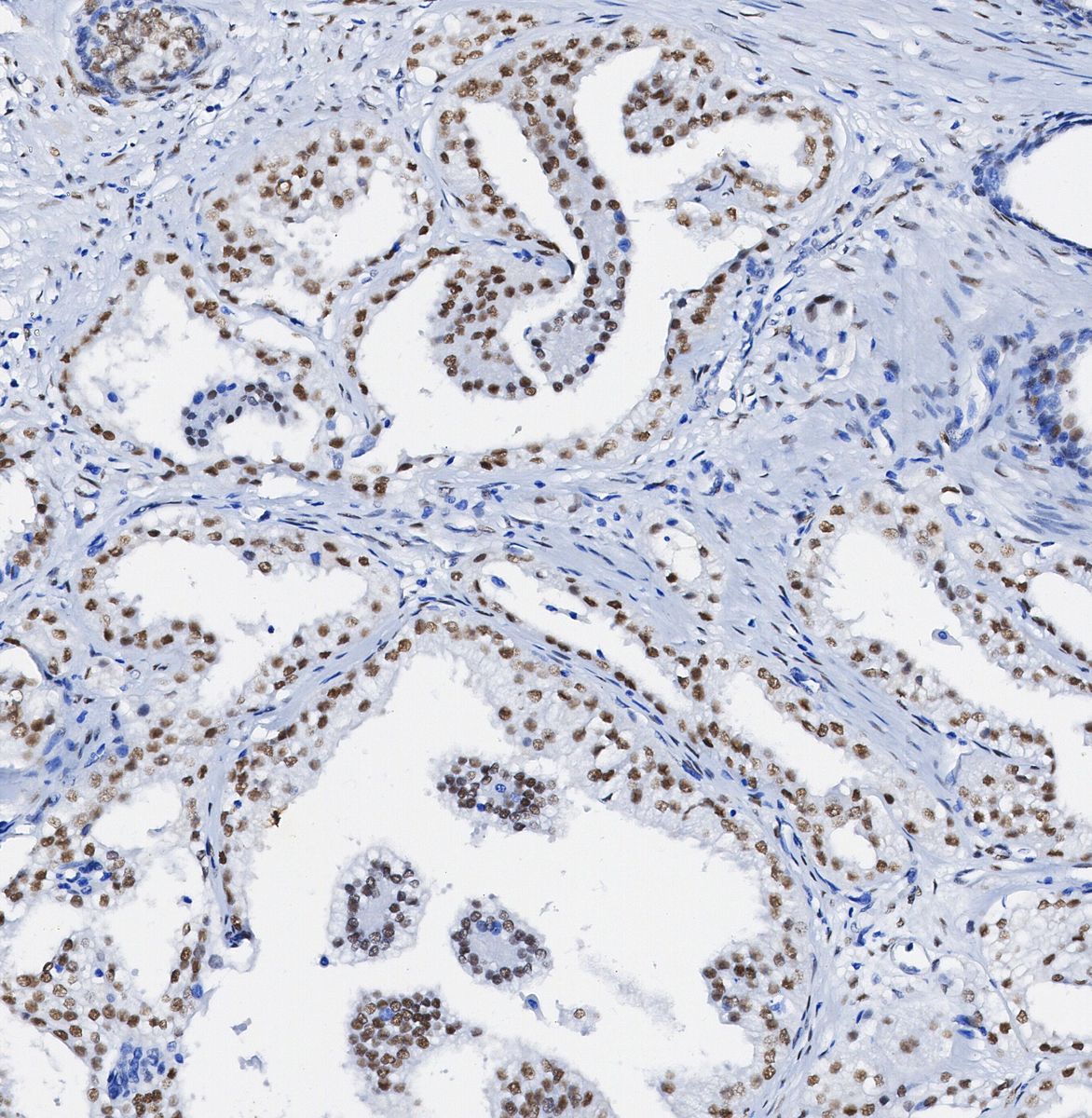Cullin 1/CUL-1 Antibody