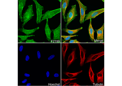 α Actinin 1/ACTN1 Antibody