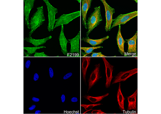 α Actinin 1/ACTN1 Antibody
