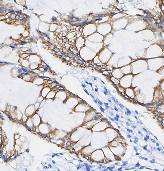 CD47 Antibody