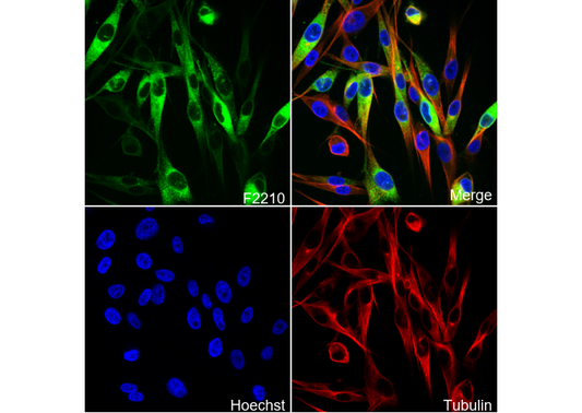 MelanA Antibody