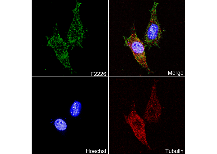 α smooth muscle Actin (acetyl Glu3) + Actin γ2 (acetyl Glu3) Antibody