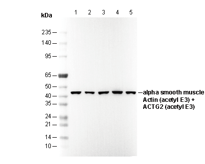 α smooth muscle Actin (acetyl Glu3) + Actin γ2 (acetyl Glu3) Antibody