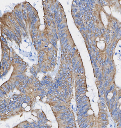 Glutamine Synthetase Antibody
